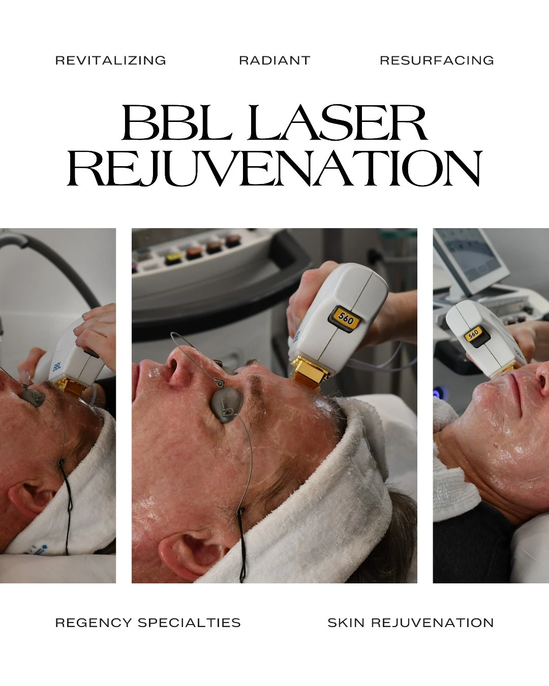BBL laser rejuvenation treatment showing revitalizing, radiant, and resurfacing benefits at Regency Specialties